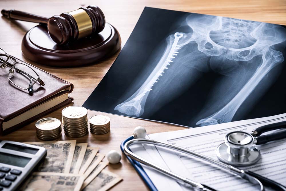 骨折診断と法的要素